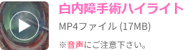 白内障手術ハイライト