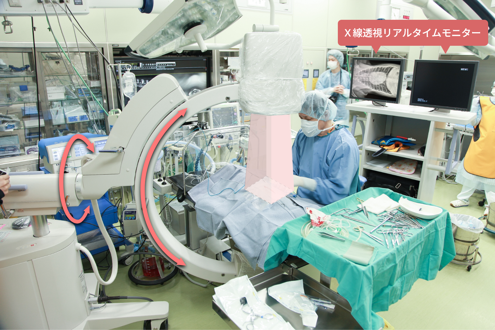 可動式X線撮影装置Cアーム導入